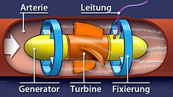 Blutstrom-Turbine Grafik