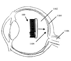 Flood-Patent Grafik