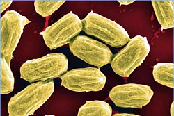 Sporen des Bacillus subtilis